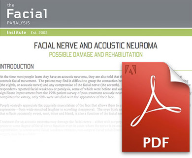 Acoustic Neuroma Facial Nerve 26