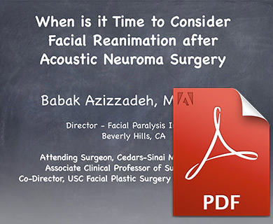 Acoustic Neuroma Facial Nerve 44
