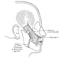 Static Sling, Otolaryngology⁠ — Head & Neck Surgery