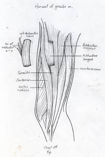 Harvest of a portion of the gracilis muscle with the adductor artery and vein
