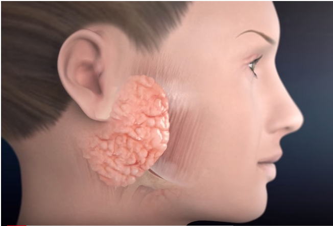 How the Facial Nerve and Parotid Gland Are Connected