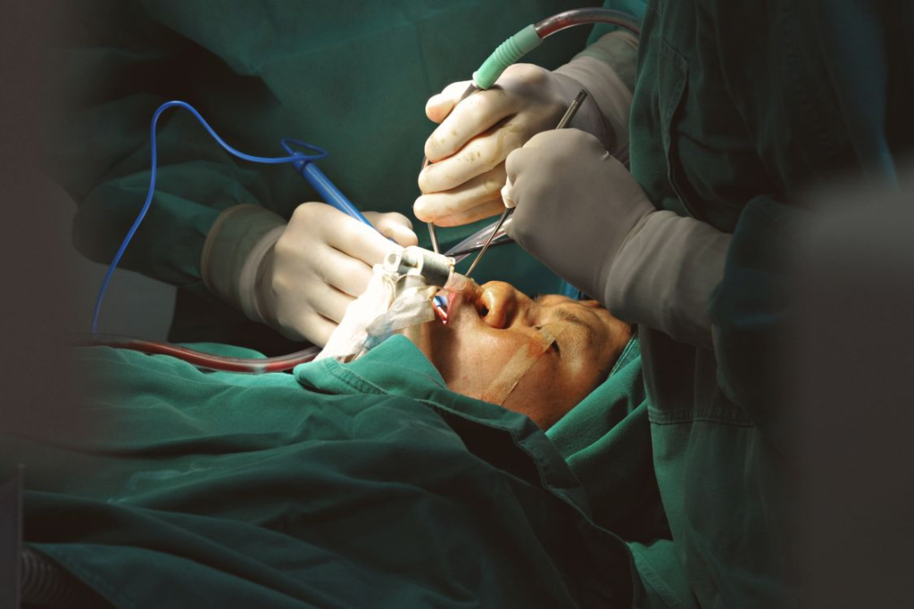 surgeons performing facial surgery in operating room