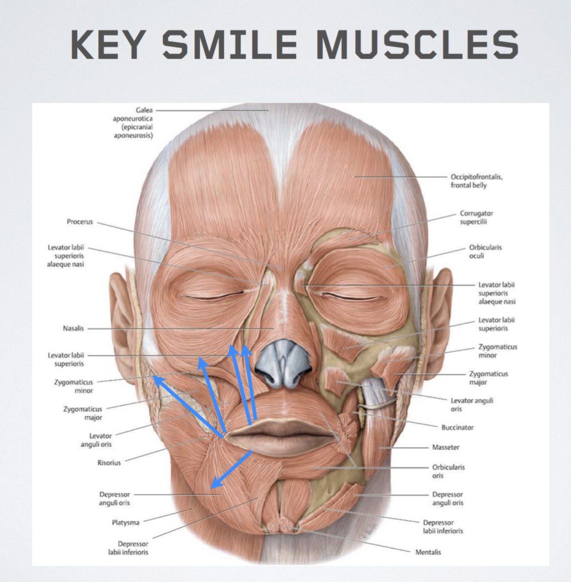 facial nerve palsy diagram