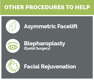 Procedures for Facial Paralysis