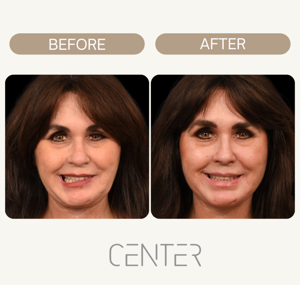Before and After work of Dr. Babak

