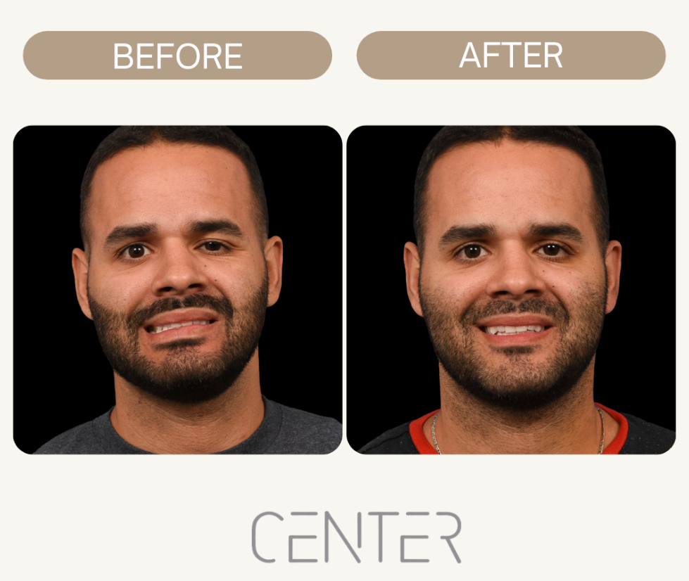  Image of a man before and after surgery