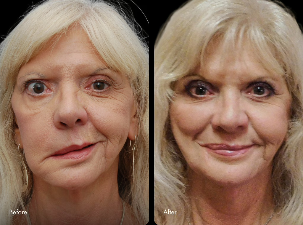 Before and After image of surgery